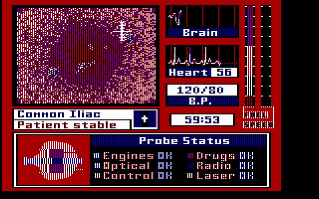 laser-surgeon-the-microscopic-mission screenshot for dos